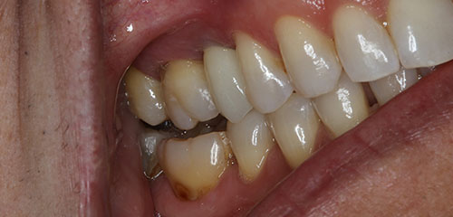 Cosmetic Dental Office Phoenix