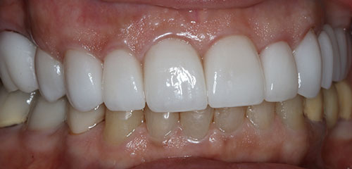 Cosmetic Dental Office Phoenix