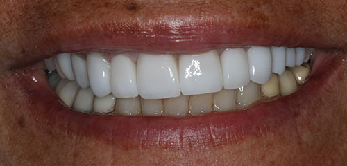 Family Dentist in Phoenix