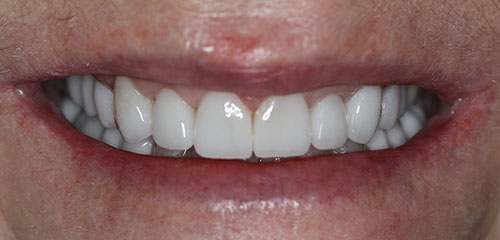 Family Dentist in Phoenix