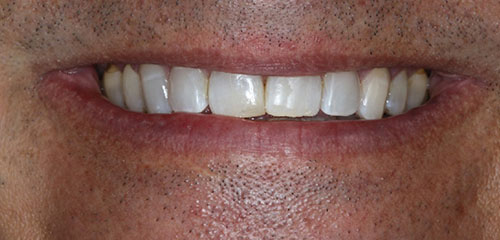 Phoenix Cosmetic Dentist