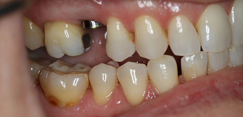 Phoenix Cosmetic Dentist